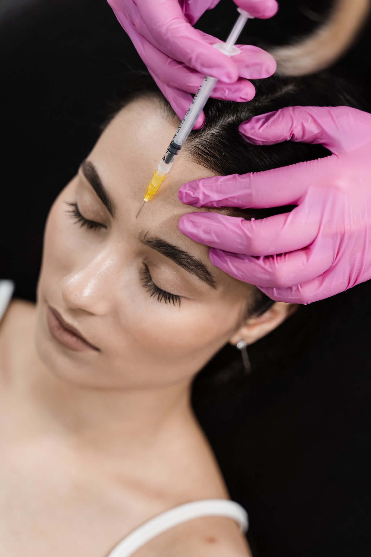 Botulinum toxin to relax and neutralize overactive muscles that cause wrinkles. Beautician is injecting botulinum toxin to correct mimic wrinkles and hyperhidrosis for young girl.